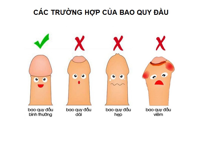 viem-bao-quy-dau-chua-benh-viem-quy-dau-o-hung-yen