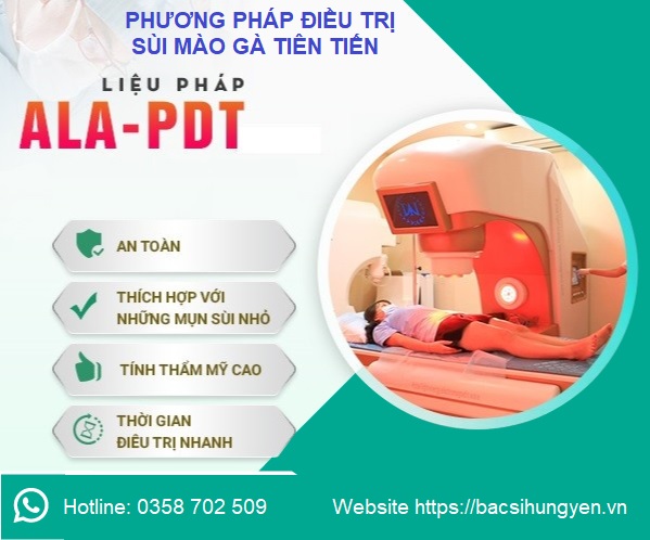 Khám chữa bệnh sùi mào gà ở Hưng Yên hiệu quả- bảo mật