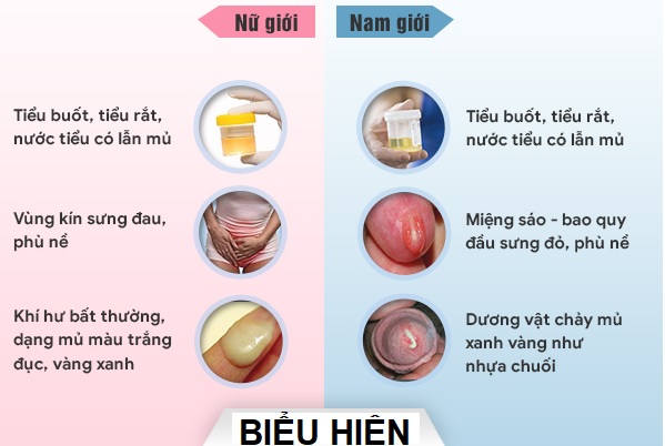 top-3-noi-kham-va-dieu-tri-benh-lau-lon-o-hung-yen