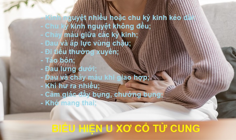 u-xo-co-tu-cung