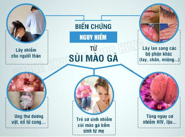 Chia sẻ phòng khám sùi mào gà ở Hưng Yên chất lượng nhất